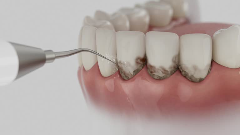Reliable Dental contractor in Bellevue, IL by Dentist Open Now